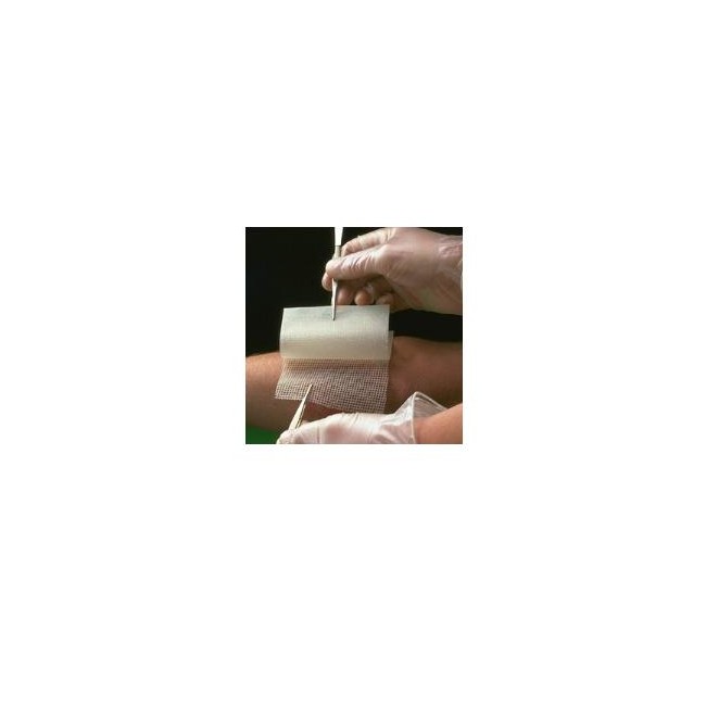 GARZA MEDICATA BACTIGRAS CON CLOREXIDINA ACETATO 0,5% 15X20CM 10 PEZZI GARZA MEDICATA BACTIGRAS CON CLOREXIDINA ACETATO 0,5% 15X20CM 10 PEZZI