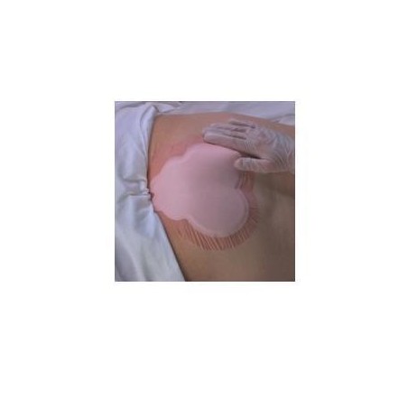 Smith & Nephew Medicazione Idrocellulare Adesiva Sterile Conformata Per La Regione Sacrale Assorbente In Schiuma Di Poliuretano