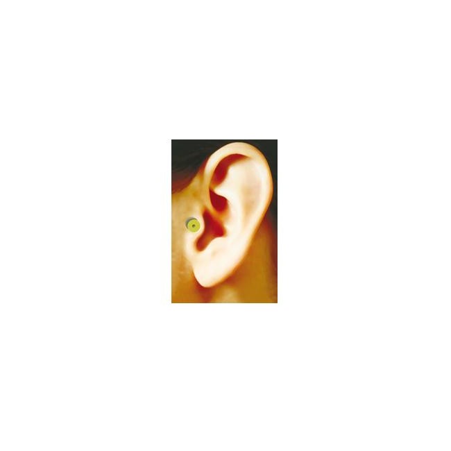 Zero Piu' Auricoloterapia Magnetica Zerodiet Per La Riduzione Del Peso 1 Pezzo Zero Piu' Auricoloterapia Magnetica Zerodiet Per La Riduzione Del Peso 1 Pezzo