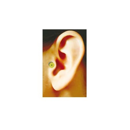 Zero Piu' Auricoloterapia Magnetica Zerodiet Per La Riduzione Del Peso 1 Pezzo Zero Piu' Auricoloterapia Magnetica Zerodiet Per La Riduzione Del Peso 1 Pezzo