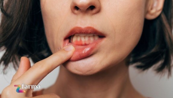 Sanguinamento delle gengive: cause e rimedi