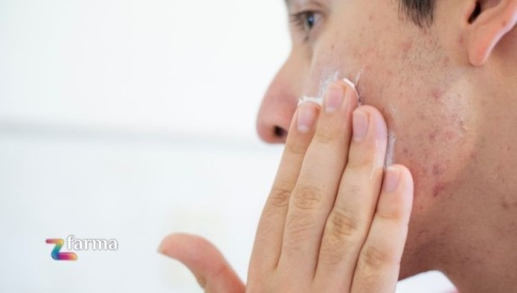 Perché è importante proteggere la pelle grassa e acneica dal sole