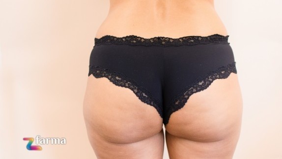 Guida completa agli integratori drenanti