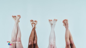 Gambe pesanti in estate: cause e rimedi efficaci