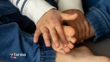 Malattia Mani Bocca Piedi: cos’è e come riconoscerla