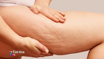 Gli integratori drenanti contro la ritenzione idrica
